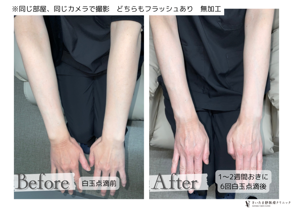 【実例紹介】白玉点滴・にんにく注射 のお知らせ【美容点滴】 1 【実例紹介】白玉点滴・にんにく注射 のお知らせ【美容点滴】