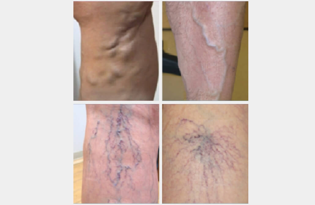 Our clinic specializes in varicose vein treatments.