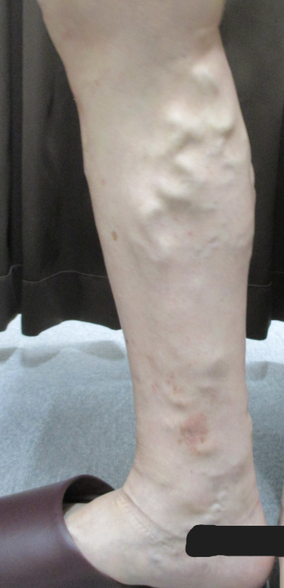 立ち仕事で夕方になると足がパンパン、デスクワークで足がむくむなど、脚のお悩みありませんか？