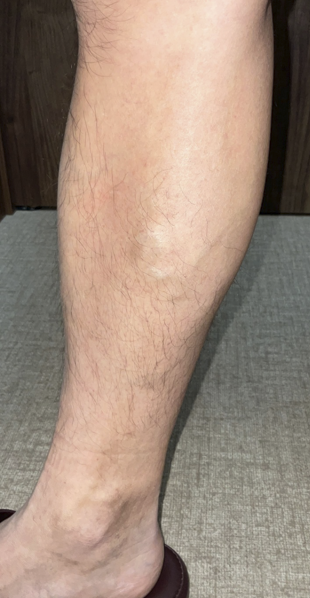 立ち仕事で夕方になると足がパンパン、デスクワークで足がむくむなど、脚のお悩みありませんか？